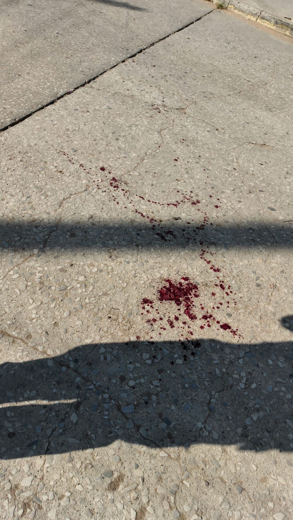 ¡CEGADO POR LA RABIA! De un machetazo casi le arranca el brazo al novio ...