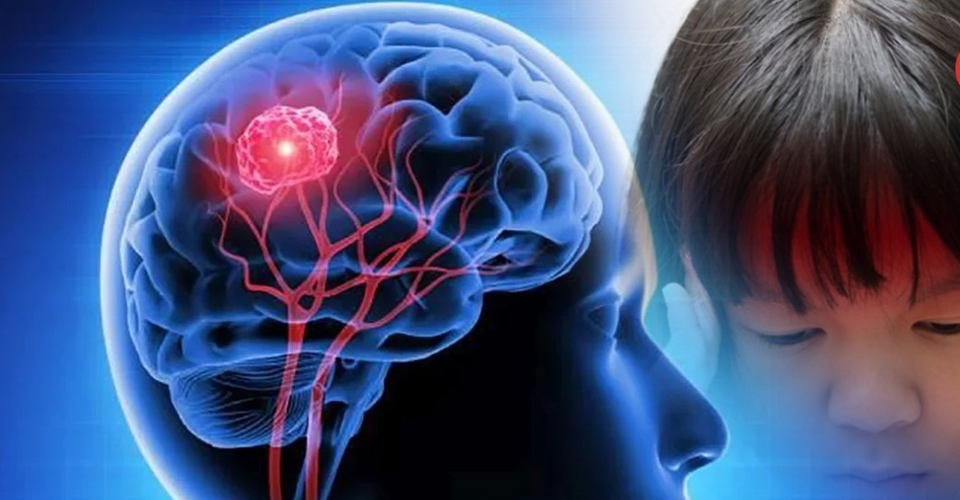 ¡INMUNOTERAPIA! Hospitales europeos ensayarán nueva estrategia contra el cáncer cerebral infantil