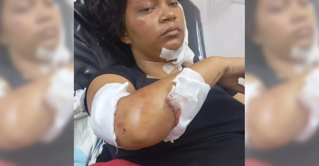 ¡VIOLA UNA ORDEN DE ALEJAMIENTO EL DESQUICIADO! Expolicía acuchilla 16 veces y arrolla a su expareja en Naguanagua
