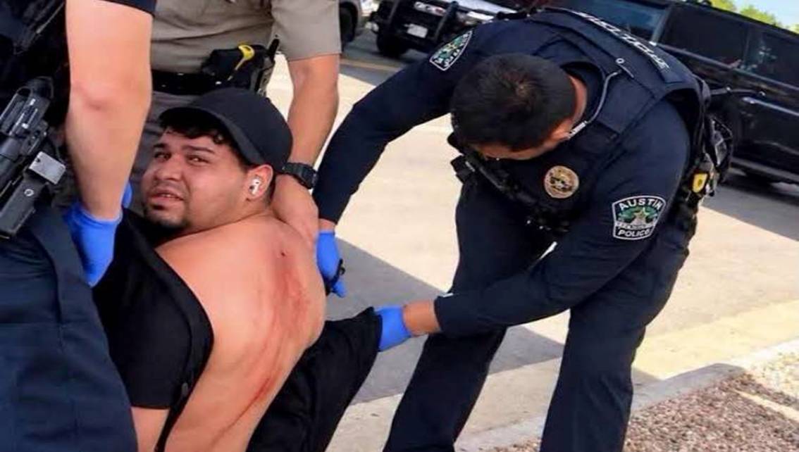 ¡LE SACAN LA BALA! Tras casi dos semanas de recibir un tiro por parte de efectivos del I.C.E intervienen al venezolano Wilber Garcés